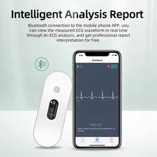 24-hour Holter monitor can generate PDF electrocardiograms and analysis reports