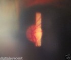 Foto 4 di 5