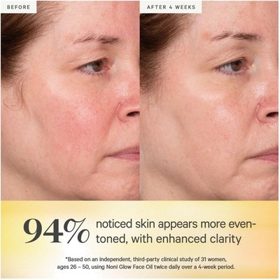 Noni Glow Hydrating Face Oil - Smooth & Radiant Skin