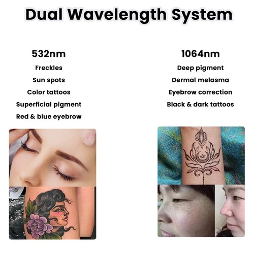 Pico ND YAG Laser Machine For Tattoo Removal Skin Whitening And Rejuvenation image 7