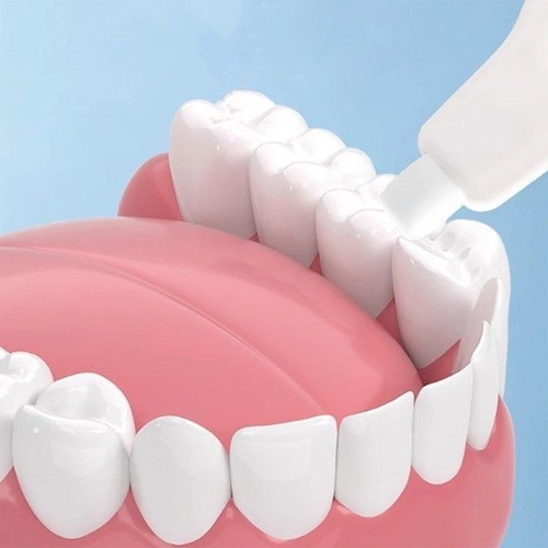 3Pcs/set Teeth Cleaning Wipe Kids Tartar Removal Plaque Stain Removal Nano - Picture 6 of 8