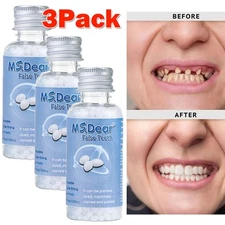 3Pack Tooth Repair Beads Granules,Temporary Moldable Dental Pellets, False Teeth