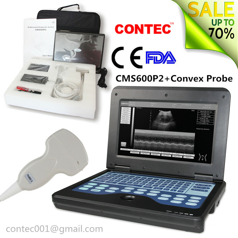 USA FedEx Digital Ultrasound Scanner Laptop Diagnostic Machine 3.5M Convex Probe