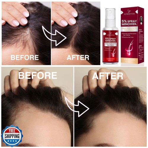 5% Hair Growth Spray For Women: Hair Regrowth Serum For Stronger Thicker Long - Picture 4 of 5
