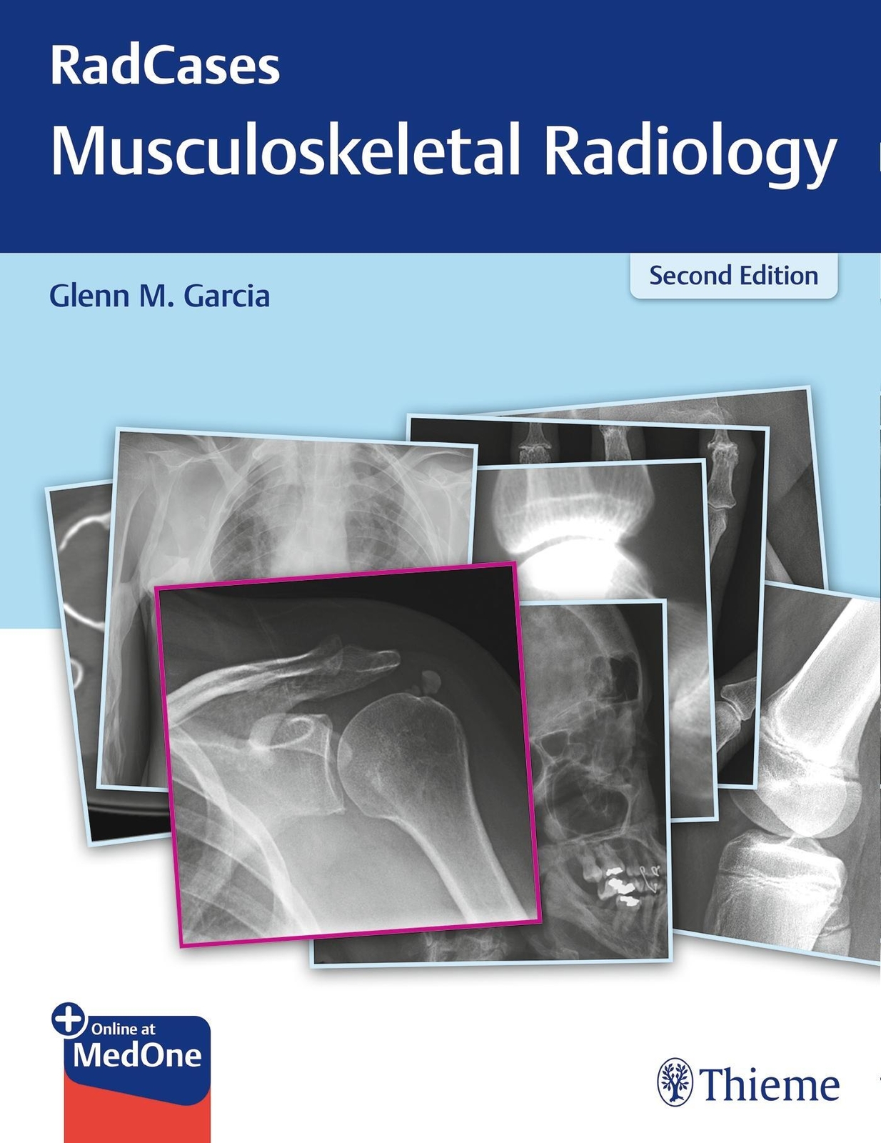 Thumbnail - Radcases Q&a Musculoskeletal Radiology | Glenn M Garcia | Taschenbuch