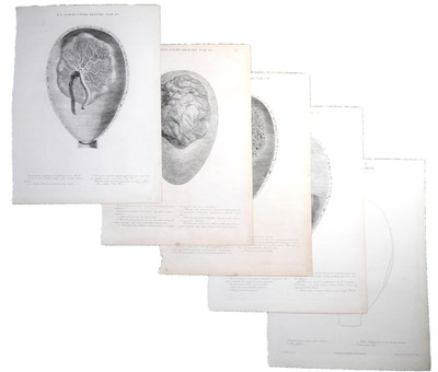 SCARCE Original 1758 Folio Engravings: ALBINUS UTERI GRAVIDAE Pl. I,II,IV,VI,VII