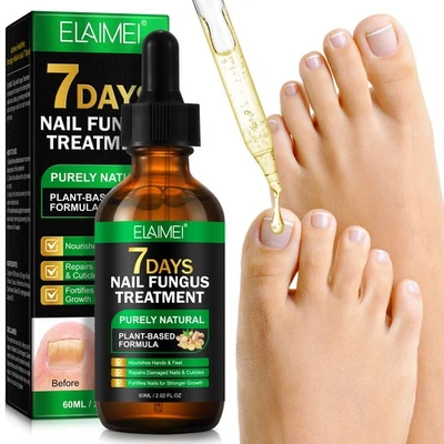 Nail Strength Serum with Ginger Extract Nail Cuticle Oil Repairs Brittle Nails - image 1 of 4