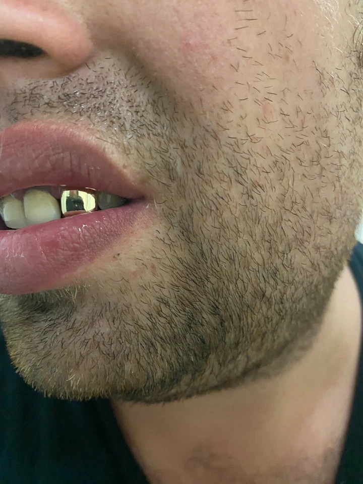 Solid 10k Yellow Gold Grillz Single Tooth Cap Hip Hop Teeth Custom Fit W. Mold - Image 2 of 4