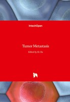 Ke Xu | Tumor Metastasis | Buch | Englisch (2016) | 266 S. | IntechOpen