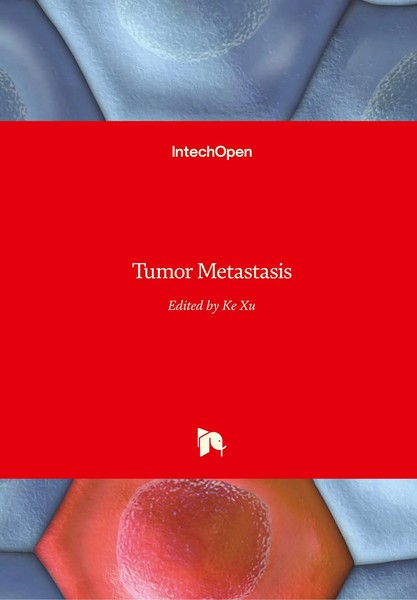 Ke Xu | Tumor Metastasis | Buch | Englisch (2016) | 266 S. | IntechOpen-image