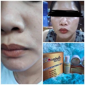dr ag advanced anti acne