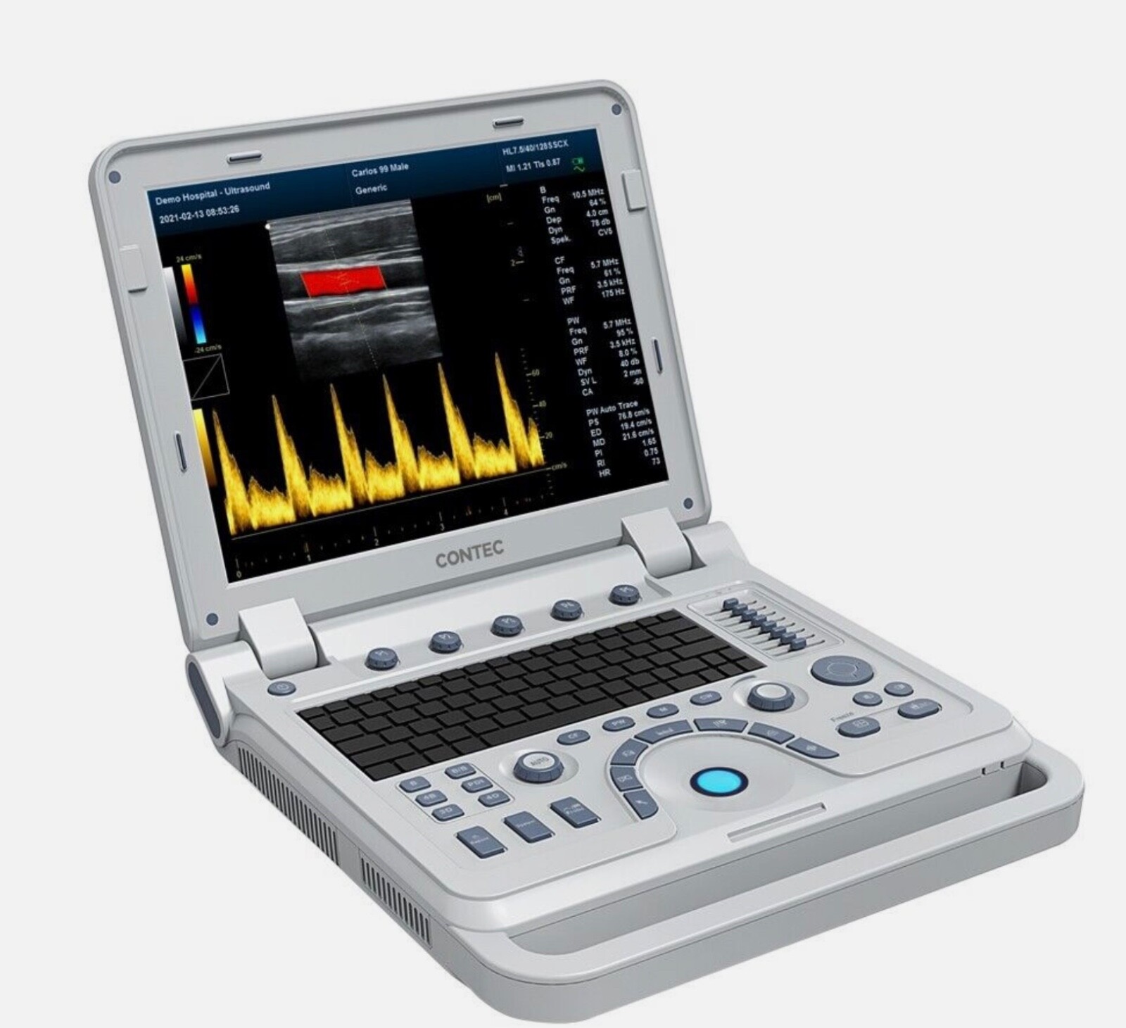 Color Doppler Ultrasound Diagnostic System Machine  model CMS1700A with 2 probes