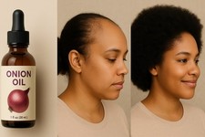 Onion Oil For Hair Growth