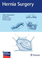 Hernia Surgery | Plus Online At Medone | Volker Schumpelick (U. A.) | Englisch