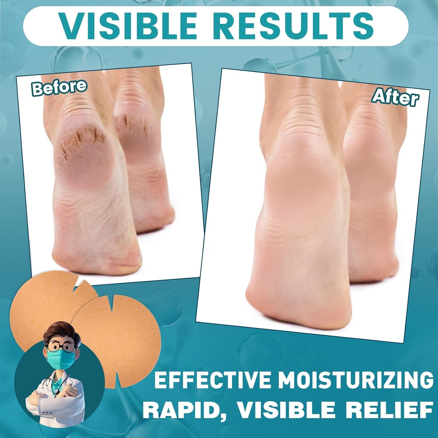 30PCS Patented Cracked Heel Treatment Patches, 80mm×80mm, Beige 