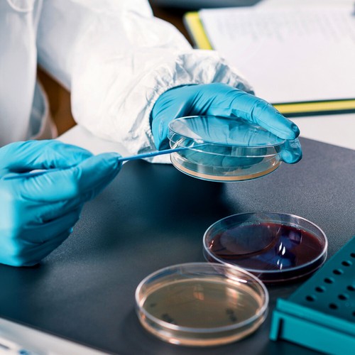 10 Stück Agar Teller Mykologie Nährstoff vorgegossen Petrischalen Papa Kind Medien - Bild 2 von 12