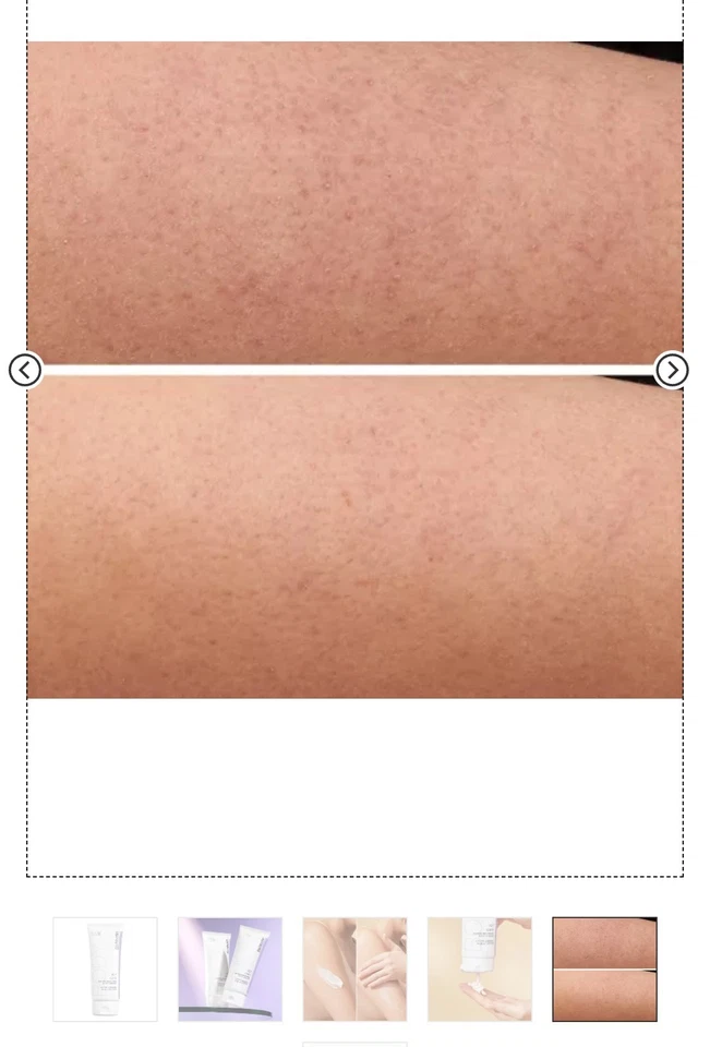 StriVectin KP Care 200 ml Crema Corporal Textura Suavizante KP Care Foto 4 de 4