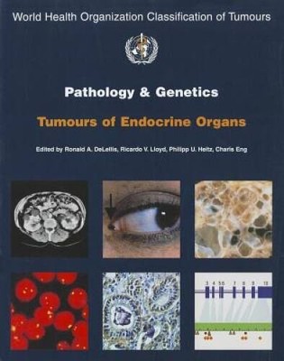 Pathology and Genetics of Tumours of Endocrine Organs (IARC WHO Classific - GOOD