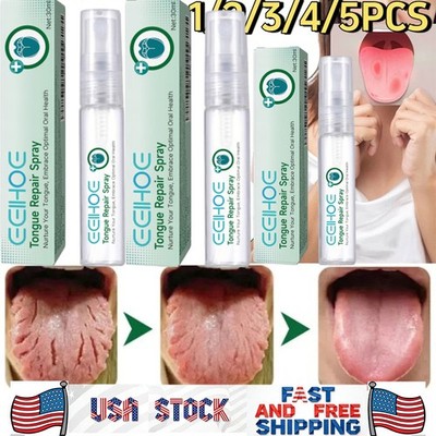 Tongue Repair Spray For Dryness& Bad Breath,Sore Tongue Relief,Oral Care Spray
