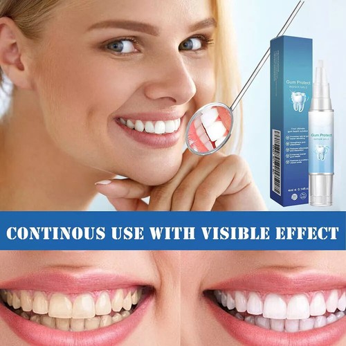 Gel Riparatore Denti per Sollievo Dolori Gengivali e Pulizia Denti Profonda - Foto 6 di 17