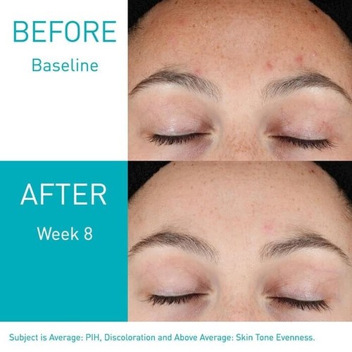 CeraVe Resurfacing Retinol Serum for Acne Marks/Pores Encapsulated Retinol 1 OZ - Picture 3 of 7