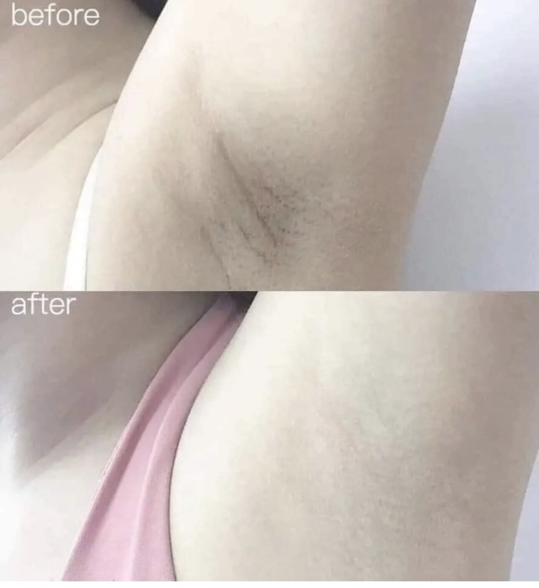 glutathione underarm whitening Liposomal Glutathione Supplement