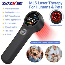Laser Therapy for Carpal Tunnel Syndrome Class 4 Therapeutic Laser Non-surgical