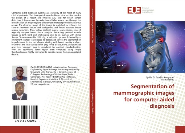 Segmentation Of Mammographic Images For Computer Aided Diagnosis Kougoum (U. A.)-image