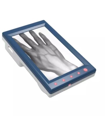 Vein Finder LCD Display, With Free Stand, Portable Vein Viewer 5.5 