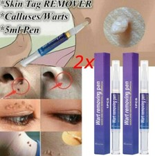 2Pcs Skin Tag Remover Pen Skin Tag Mole Wart Dark Spot Remover Painless  Safe