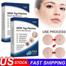 1BOX/144PCS Skin Tag Remover Patches Quick Effective Mole Wart Removal Pad 