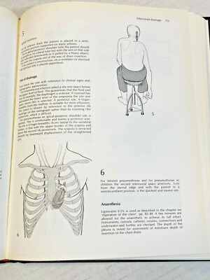 Rob & Smith's Operative Surgery Thoracic & Cardiac Surgery 2