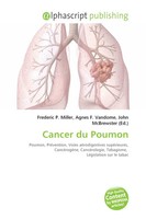 CristóBal Barnabas | Cancer Du Poumon | Taschenbuch | FranzöSisch (2026)