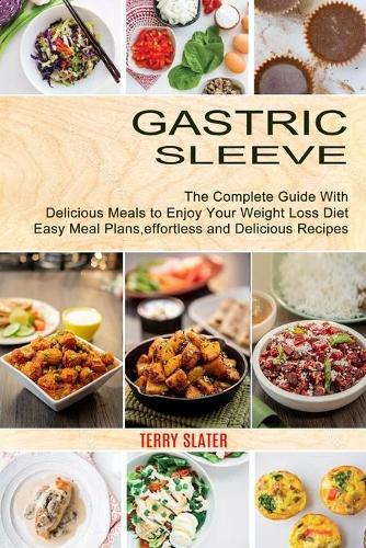Thumbnail - Terry Slater Gastric Sleeve (taschenbuch)
