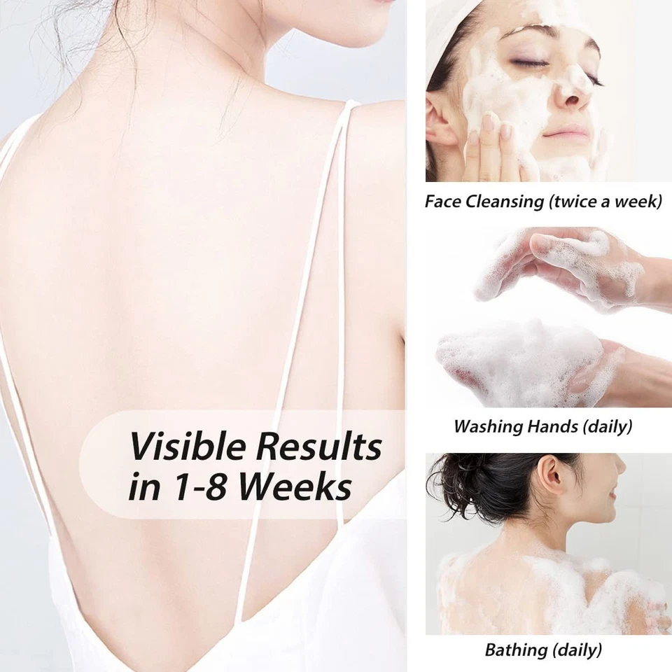 5 PCS ShangHai Sulfur Soap Acne Blemish  Anti-Mites  Itch Excess Oil (85g/1 PCS) - Image 2 of 4