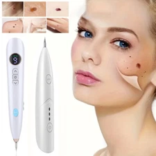 Electric Laser Plasma Mole Removal Pen Dark Spot Remover Skin Wart Tag Tattoo US