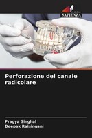 Pragya Singhal (U. A.) | Perforazione Del Canale Radicolare | Taschenbuch (2023)