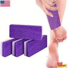 2 PCS Foot Pumice Stone for Feet Hard Skin Callus Remover and Scrubber, Pedicure