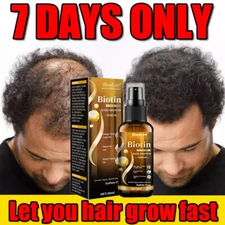 Biotin Hair Growth Spray Anti Hair Loss Fast Regrowth Scalp Treatment Serum US
