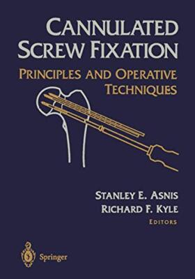 Asnis - Cannulated Screw Fixation - New paperback or softback - X555z