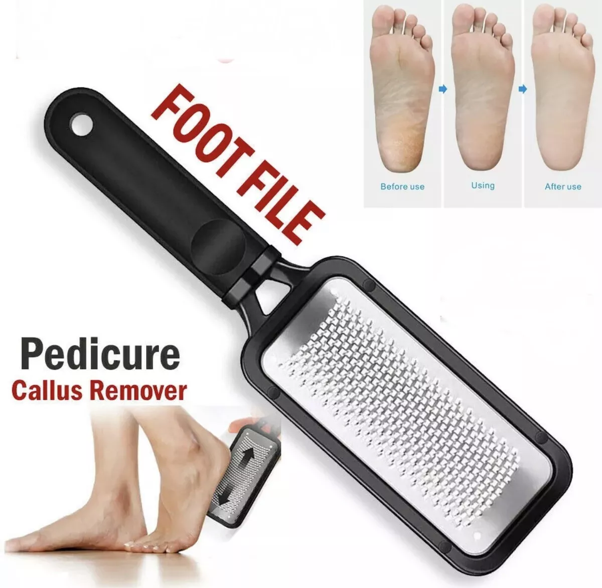 Foot Scrubber Callus Remover, Pedicure Metal Tool Heel Foot Scraper for Dead Skin, Callus, Cracked Heels, Hard Skin Remover, Size: One Size