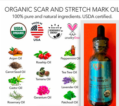 KOKOS Organic face & body oil, scar, stretch mark,Rosehip, Wheat Germ, Argan...