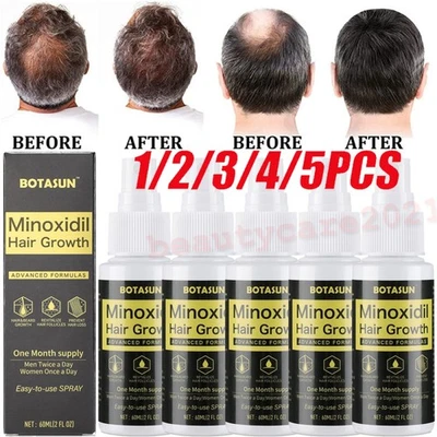 BOTASUN Minoxidil 5% Spray Men Hair Regrowth Treatment Topical Solution 1-5 Month Supply