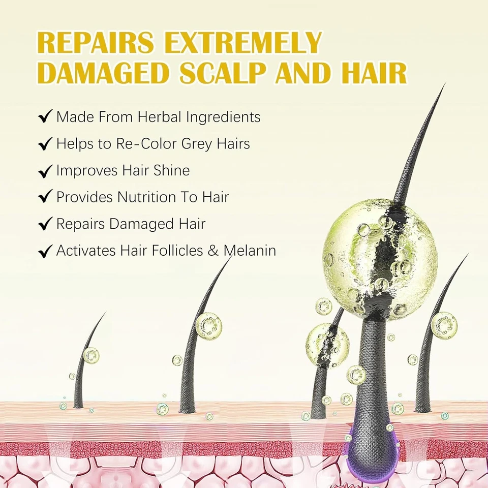 Óleo de crescimento capilar 5% minoxidil - soro de crescimento extra forte para homens e mulheres - Imagem 4 de 4