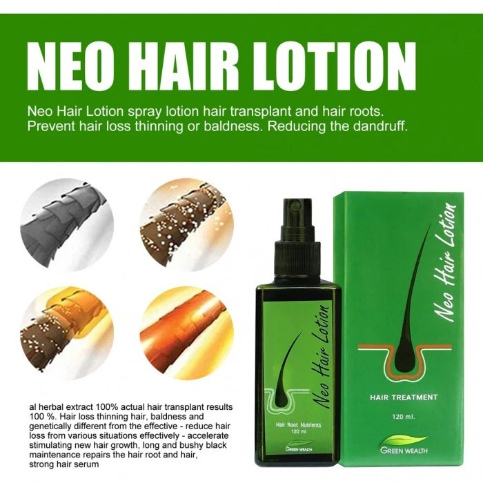 3 botellas neo Loción Capilar Green Wealth Tratamiento Crecimiento para Caída del Cabello, Patillas Foto 3 de 4