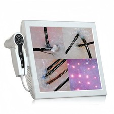 Professional 15-Inch Scalp Camera for Beauty Salons   High-Resolution Hair