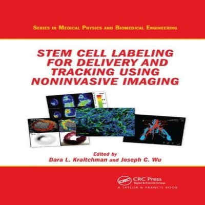 Stem Cell Labeling for Delivery and Tracking Using Noninvasive Im