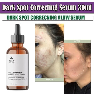 Anti-Aging Whitening Moisturizing Firming Face Serum Anti Acne Spot Wrinkles