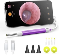 Endoscope Otoscope Camera HD Ear Camera Cleaning Ear Wax Removal Cleaner Kit