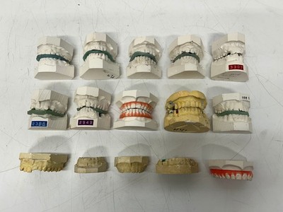 Lot 25 Vtg Dental Plaster Real Tooth Teeth Molds Dentist Cast Impressions #C